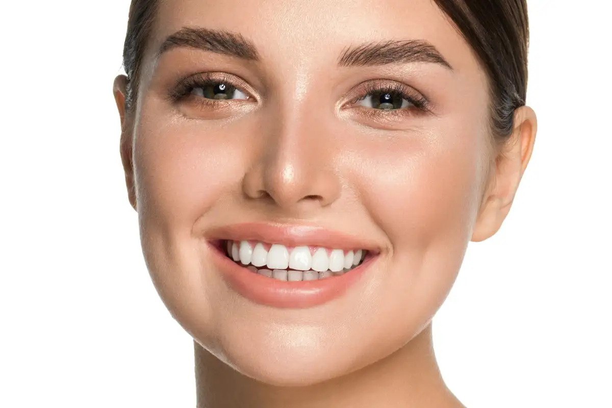 ابتسامة مشرقة توضح نتائج التبييض – هل تبييض الأسنان في المنزل آمن